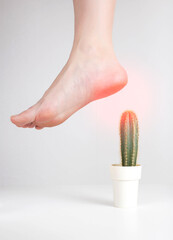 Human foot stepping on a cactus on a white background. Concept of stitching pain in the heel to the...
