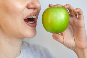 A girl with braces on her teeth wants to bite a green apple.