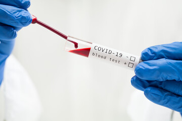 Lab technician dropping blood sample in test tube container using pipette
