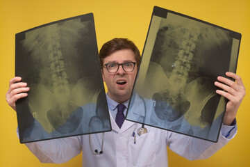 Male doctor holding x-ray or roentgen image being confused with results.