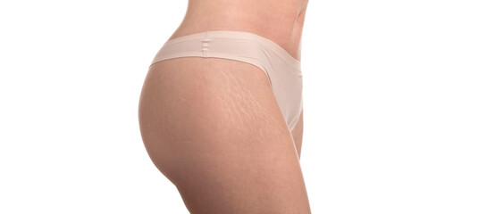 Stretch marks on woman's buttocks close up