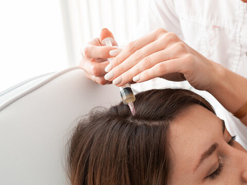 Young woman with hair loss problem receiving injection, close up. Cosmetology - plasma injection into the scalp - aesthetic medicine - safe restoration of healthy skin. Mesotherapy