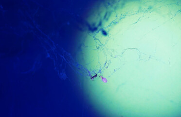 Spider web