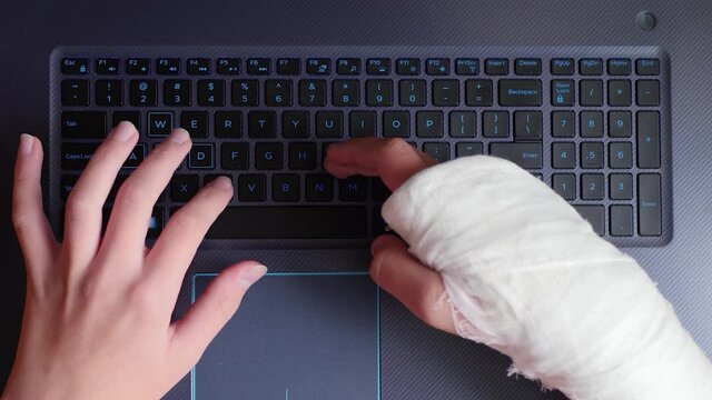 Teenager's hand in cast works with a laptop using productive work. Broken arm in bandages is typing on keyboard close-up top view