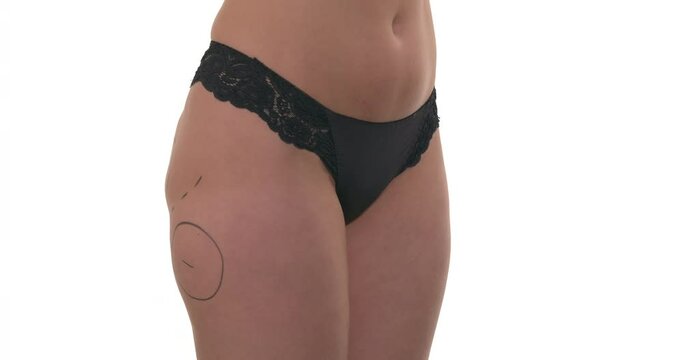 Marking problem parts of Caucasian woman buttocks. Preparation before buttock augmentation surgery. Slow motion. Beauty concept. Isolated on white background