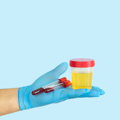 Doctor holding urine and blood samples for test