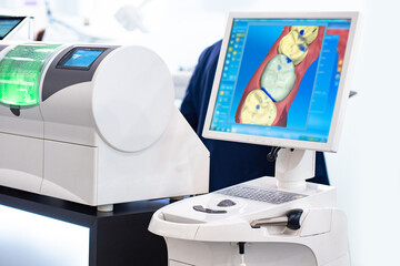 Modern technologies in dental industry. Digital dentistry concept. Digital scan of human teeth. Result is displayed on a blue screen. Equipment for dentistry. Prosthetics at dental industry