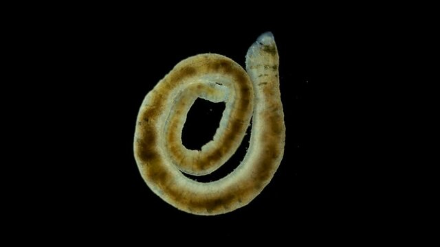 Ophidonais serpentina worm under a microscope, Oligochaeta Subclass, Naididae Family. Sample found in the Volga River