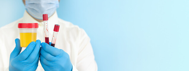 Doctor holding urine and blood samples for test
