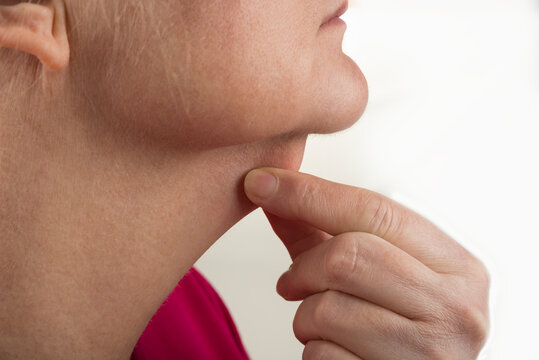 Female Double Chin From Profile For The Surgery
