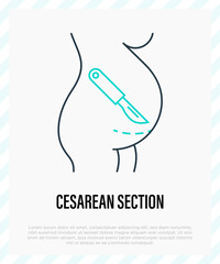 Cesarean section thin line icon. Scalpel near belly. Surgical operation for childbirth. Vector illustration.