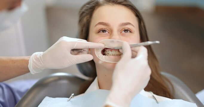 Girl with dental braces during an orthodontic treatment. Close-up on a patient's mouth opened with dental optragate