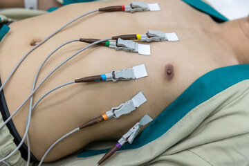 Heart electrocardiogram or monitoring using Holter for young patient. Male athlete does a cardiac stress test. wearing Holter monitor device for daily monitoring of an electrocardiogram. 