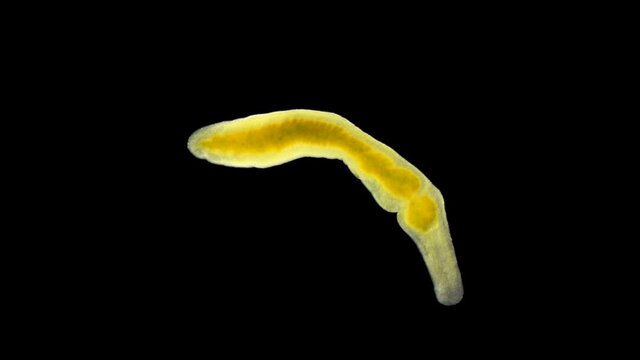 A flatworm of the Prorhynchidae family under a microscope, Order Lecithoepitheliata, sample found at Lake Baikal.