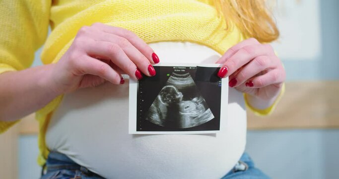 Close up of pregnant tummy and woman's hands holding sonogram image of healthy unborn baby. Wife holding ultrasound baby picture in hand. Pregnancy and maternity healthcare concept.