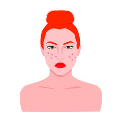 A woman with red hair is upset with acne on her face. Vector illustration of problems on the female skin of the face