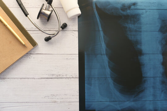 xray photography , digital tablet on white background 