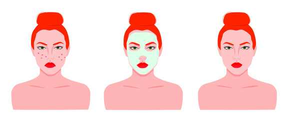Vector set of facial skin care. Woman with red hair doing acne prevention