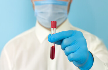 Technician holding blood sample tube in medical laboratory for research