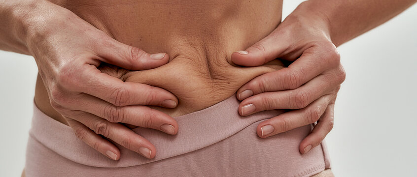 Slim middle aged caucasian woman squeezing flabby skin
