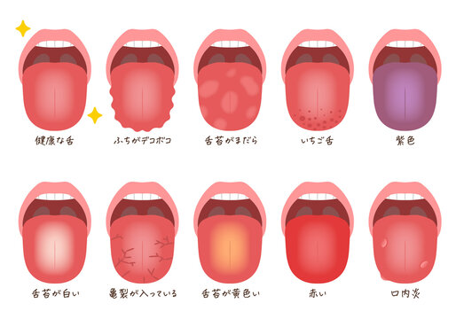 173 件の最適な べろ 画像 ストック写真 ベクター Adobe Stock