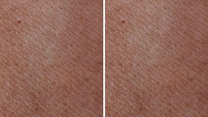 Side by side Close-up Brighten and Lighten Dull Skin texture