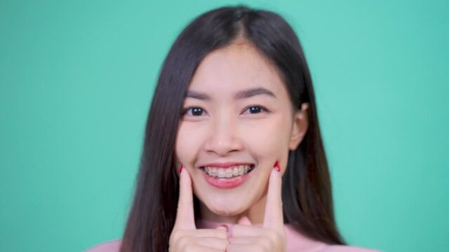Beautiful smiling of young asian woman with retainer braces with white teeth increase confidence