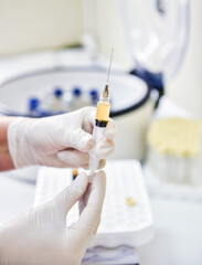 Platelet-Rich plasma preparation. Syringe with plasma in hands
