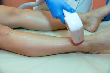 Laser hair removal procedure in a beauty salon. Removal of unwanted leg hair. Master works with a laser hair removal machine, hands close-up.