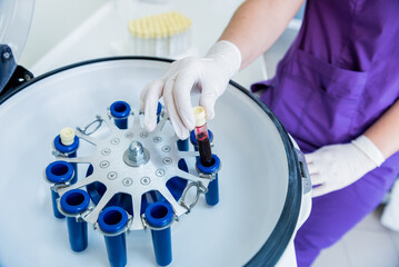 Platelet-Rich plasma preparation. Tube with blood in hands