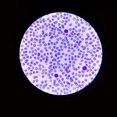 microscope blood drop