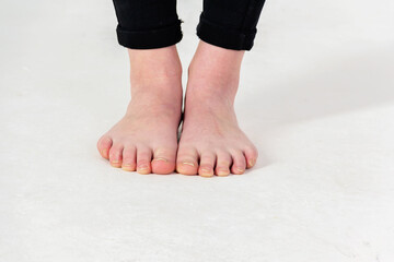 Female feet close up on a white background.