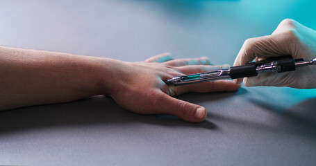 RFID chip implantation process in clinic