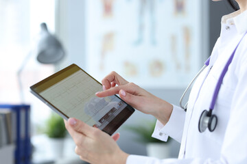 Doctor is holding tablet with heart cardiogram