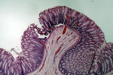 Microscope photo of rectum cells of a dog.