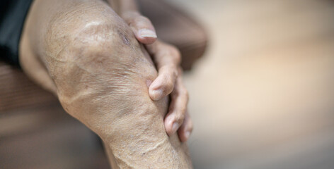 Naklejka premium Close up of old man hand holding on the knee with suffering from knee pain. The sick legs of an old man with severely deformed knees affected by arthritis.