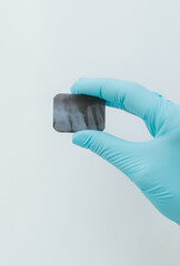 Hand in blue glove holding small dental x-ray.