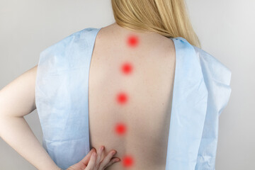 A woman at the doctor's appointment with back pain. Treatment of spinal deformity and stoop....
