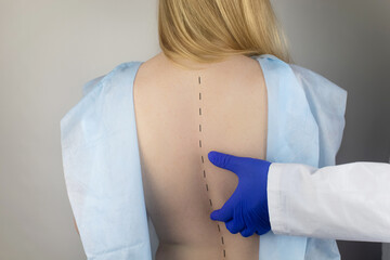 A woman at the doctor's appointment with back pain. Treatment of spinal deformity and stoop....