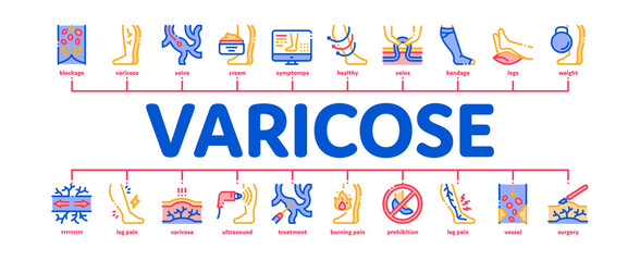 Varicose Veins Disease Minimal Infographic Web Banner Vector. Varicose Symptoms And Treatment, Legs Pain And Medicine Cream, Ultrasound And Surgery Color Illustration