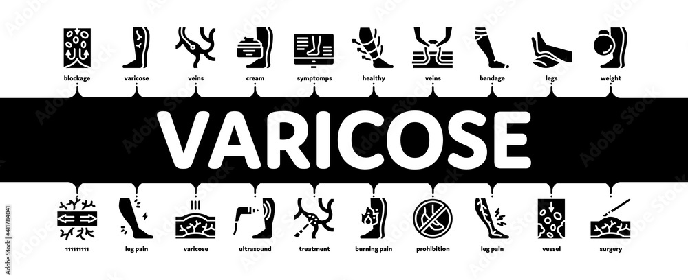 Wall mural Varicose Veins Disease Minimal Infographic Web Banner Vector. Varicose Symptoms And Treatment, Legs Pain And Medicine Cream, Ultrasound And Surgery Black Illustration