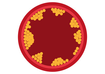 Corte de vena con colesterol en fondo blanco.