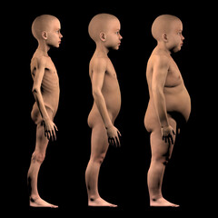 Undernourished child, with normal build and obese child in comparison. Problems of food shortage and obesity in children. 3d render 

