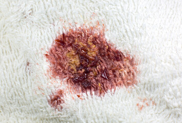 Fototapeta premium Dirty food stain on white cotton towel or carpet. Close up photo.