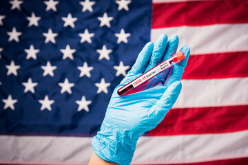 Hands of doctor wearing gloves holding blood test tube coronavirus (COVID-19) virus in the laboratory on flag United States of America background, USA Vaccination