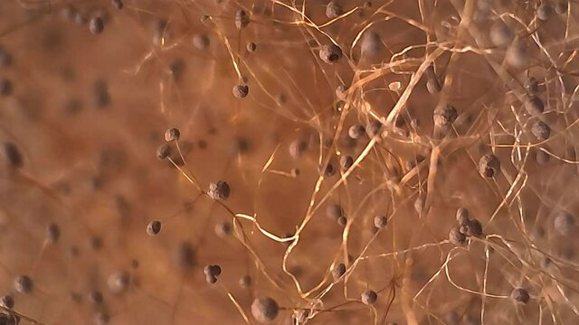 Microscope Mold Sporangium and Sporangiospore 600x Lighting Biology Fungi