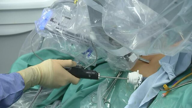 Laparoscopic Surgery. Doctor's Hand In Glove. Close Up.