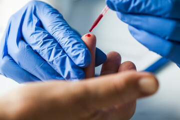 Medical technician EMS doctor taking finger prick PRP patient blood sample using pipette
