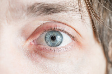 light gray-blue eye looks directly into the lens. Close-up