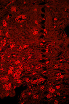 Granulation tissue